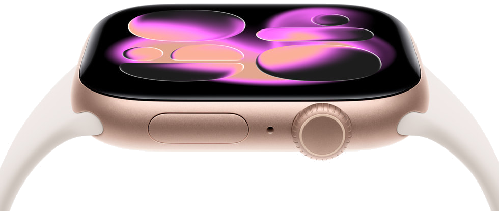 Apple Watch Series 11 GPS + Cellular